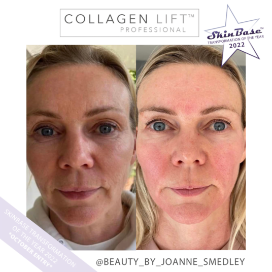 BEAUTYBYJOANNESMEDLEY winter transformation BEAUTYBYJOANNESMEDLEY winter transformation