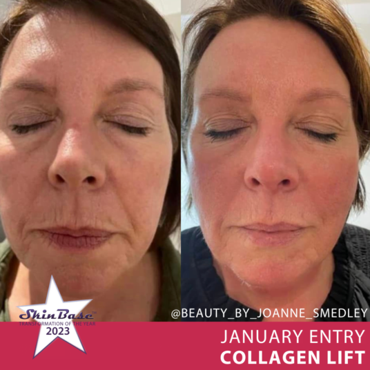 January Transformation of the Year January Transformation of the Year