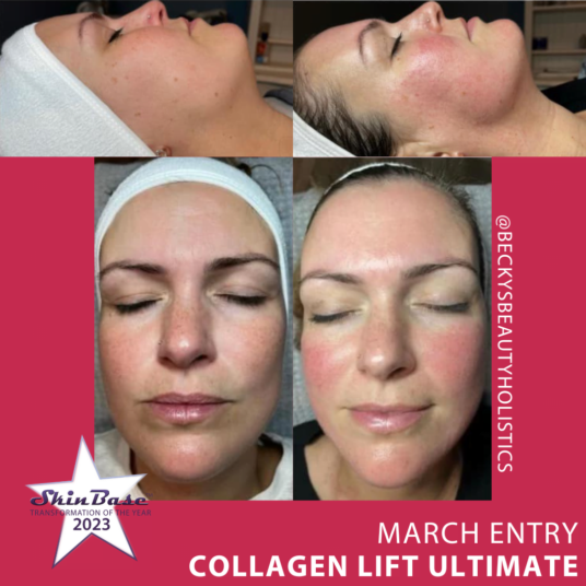 BECKYSBEAUTYHOLISTICS Collagen Lift Ultimate BECKYSBEAUTYHOLISTICS Collagen Lift Ultimate