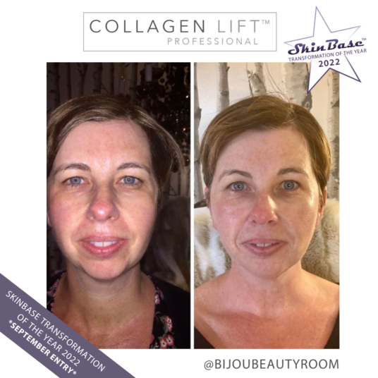 BIJOUBEAUTYROOM2 BIJOUBEAUTYROOM