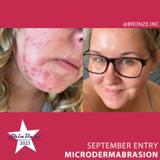 BRONZEINC last day to vote BRONZEINC last day to vote