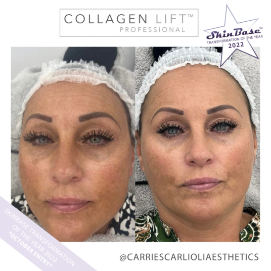 CARRIESCARLIOLIAESTHETICS1 CARRIESCARLIOLIAESTHETICS1