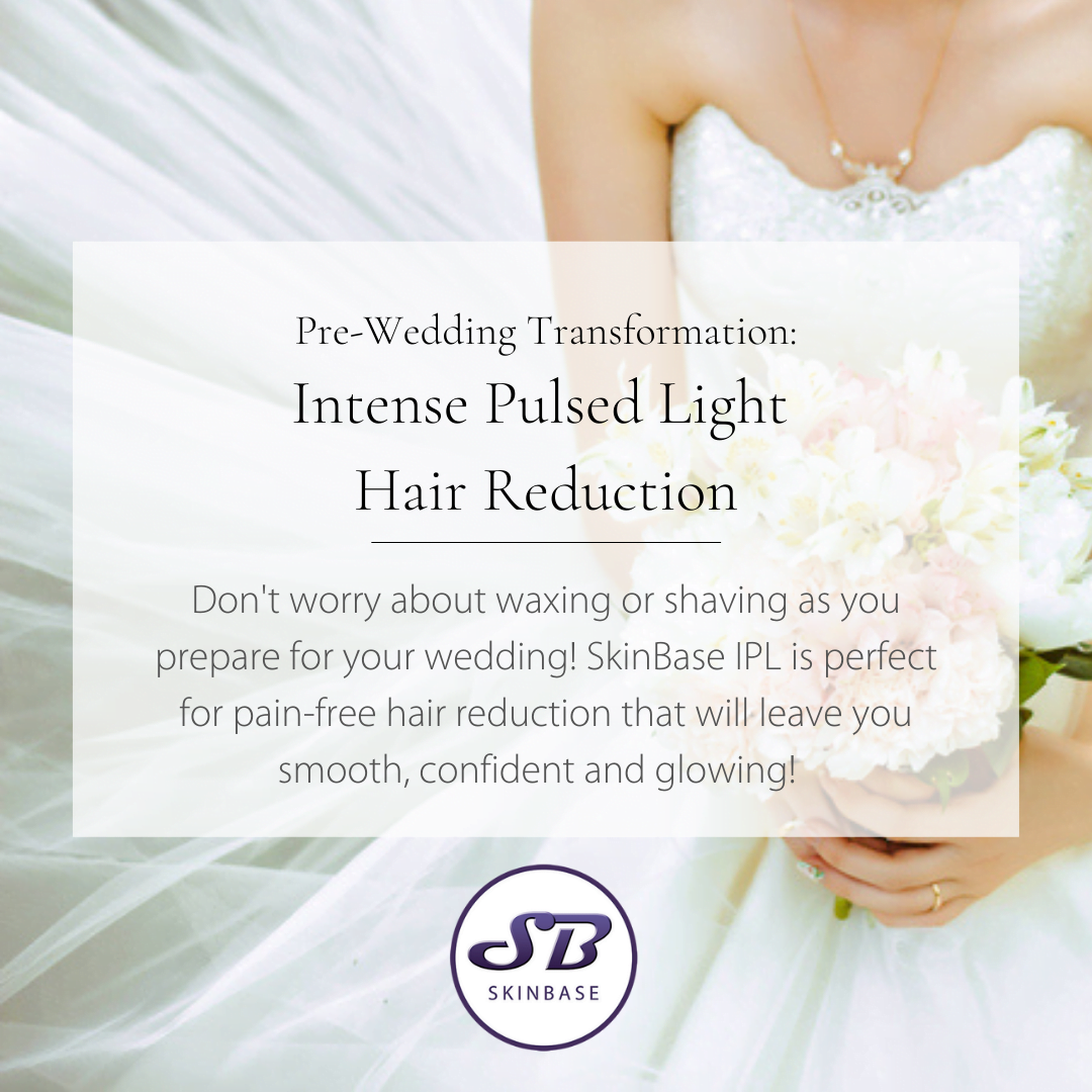 wedding season marketing content