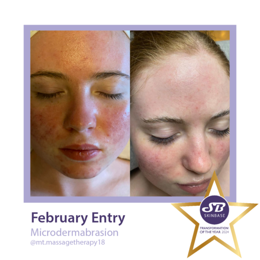 confidence boosting SkinBase treatments - mt massage therapy confidence boosting SkinBase treatments - mt massage therapy