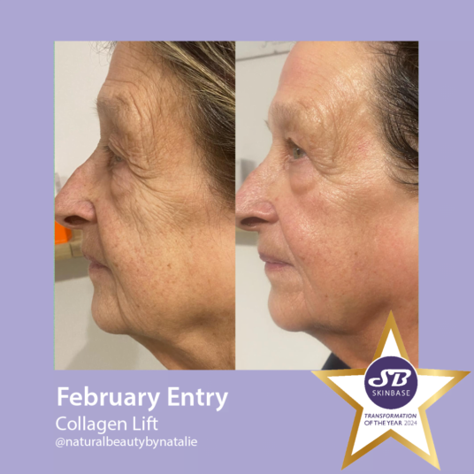 confidence boosting SkinBase treatments - natural beauty by Natalie confidence boosting SkinBase treatments - natural beauty by Natalie