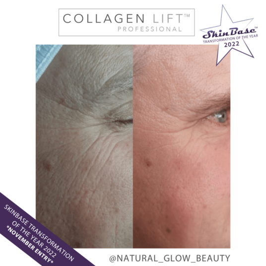 NATURALGLOWBEAUTY2