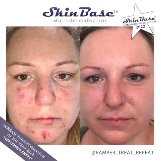 transformation of the year pamper treat repeat