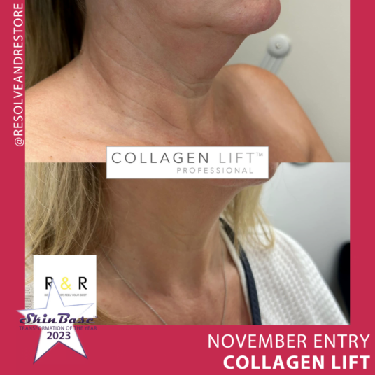 November Collagen Lift Entries November collagen lift entries: Resolve and Restore