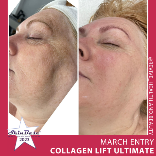 REVIVEHEALTHANDBEAUTY Collagen Lift Ultimate REVIVEHEALTHANDBEAUTY Collagen Lift Ultimate