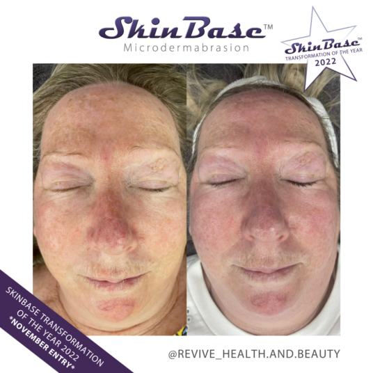REVIVEHEALTHANDBEAUTY2 november skin