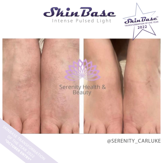 SERENITYCARLUKE SKIN CONCERNS SERENITYCARLUKE SKIN CONCERNS