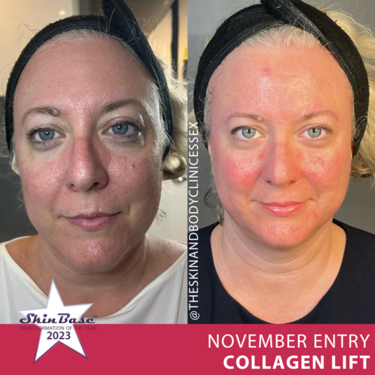 THESKINANDBODYCLINICESSEX2 THESKINANDBODYCLINICESSEX2