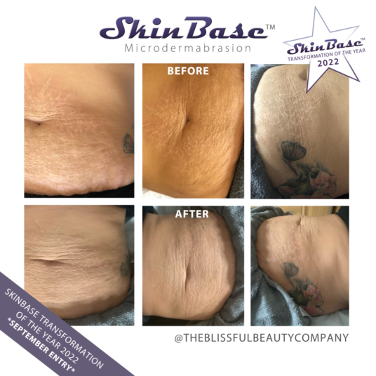 THE BLISSFUL BEAUTY CO post-pregnancy