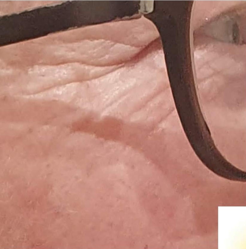 before and after collagen lift awaken face and body care 1