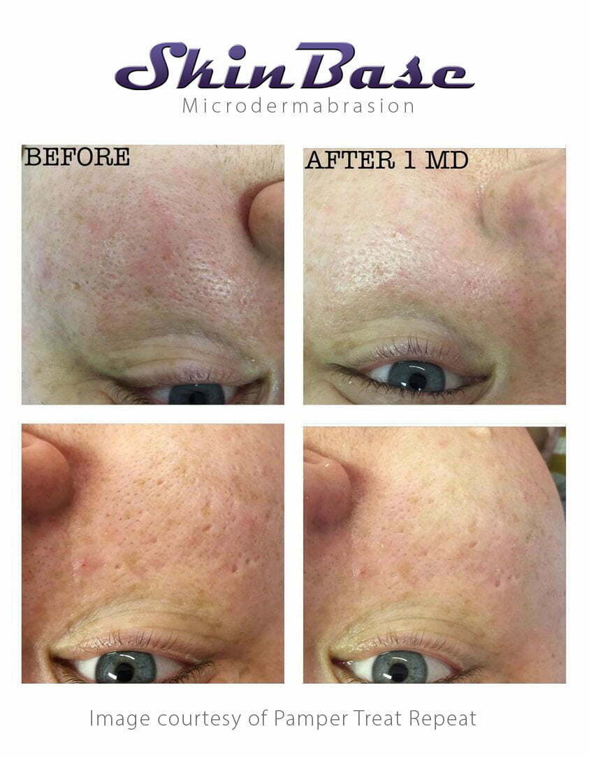 md-pamper-treat-1