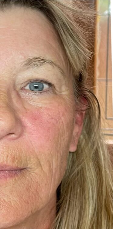 SkinBase Collagen Lift ULTIMATE - best facial for ageing skin - Bijou Beauty Room 2