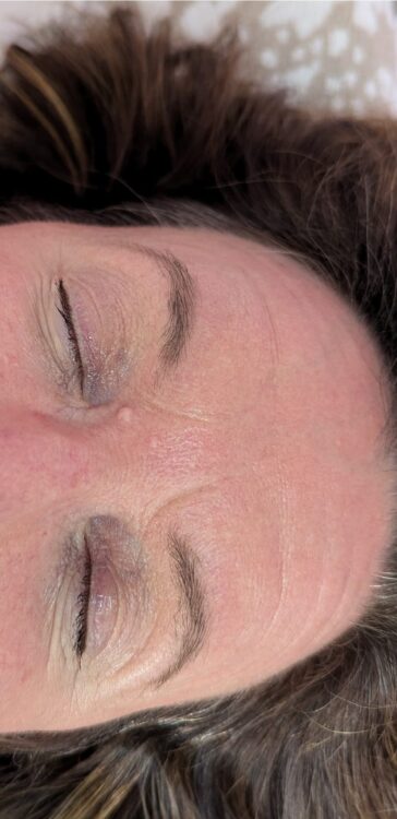 before and after collagen lift for fine lines and wrinkles Glam Beauty Education 1