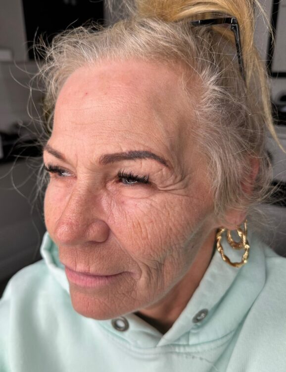 collagen boosting hydrating facial before and after SkinBase Collagen Lift Sammy's Cosmetic Aesthetics 1