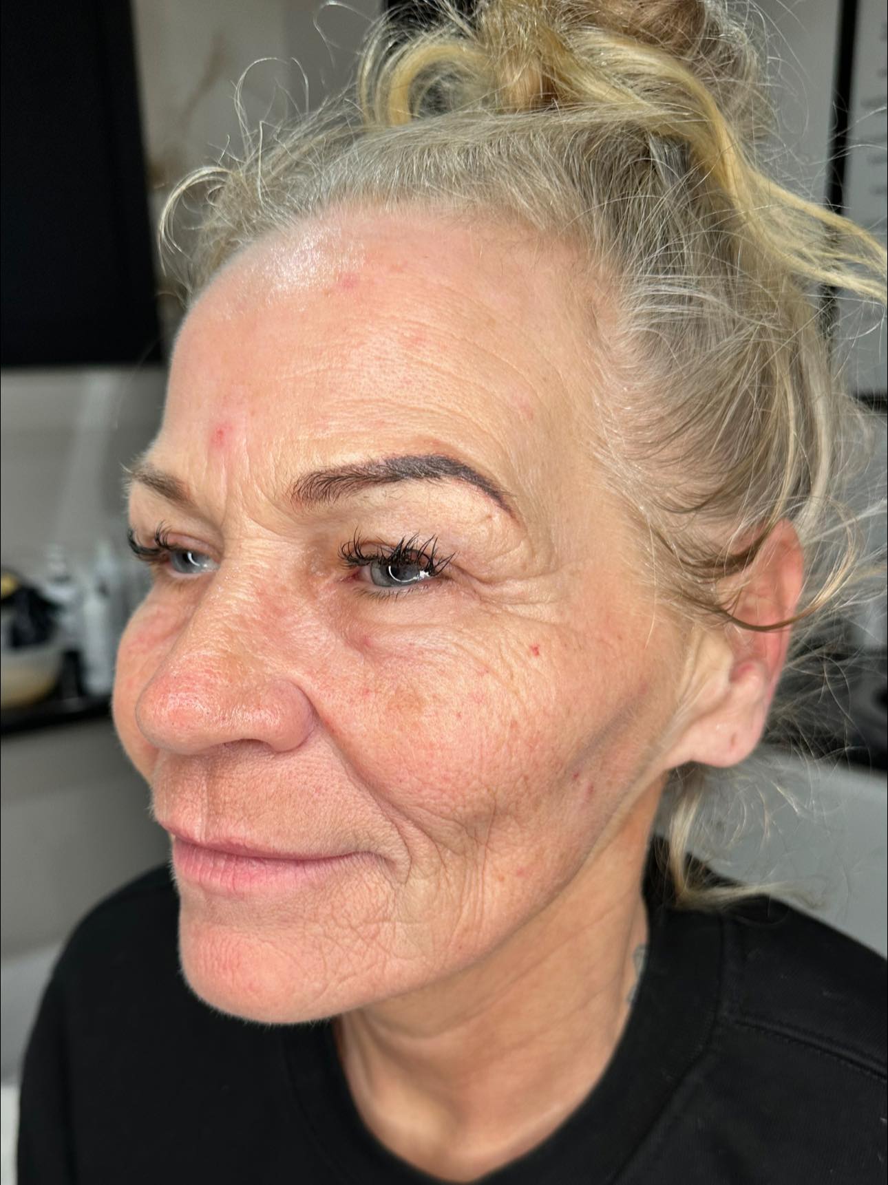 collagen boosting hydrating facial before and after SkinBase Collagen Lift Sammy's Cosmetic Aesthetics 2