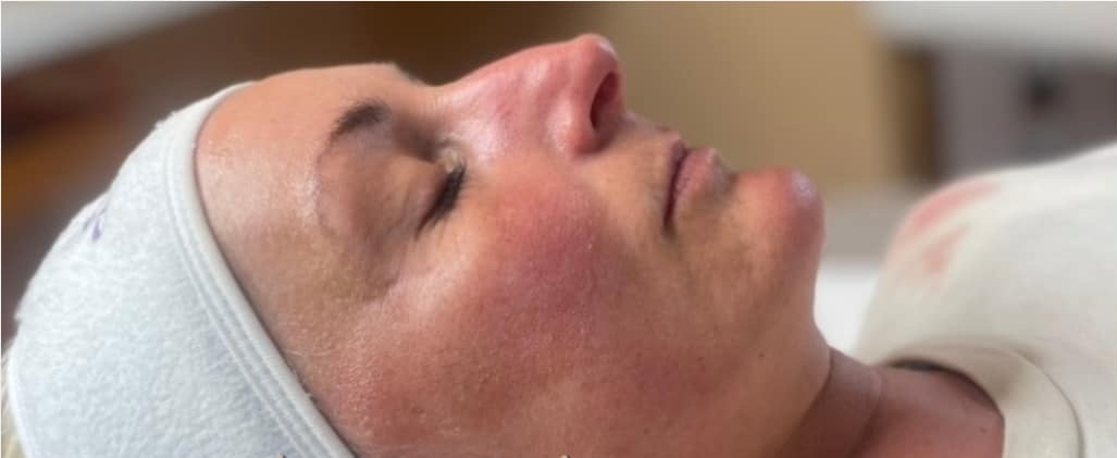 collagen boosting skin treatment for greater confidence - SkinBase Collagen Lift ULTIMATE Be Beautiful Torbay 1