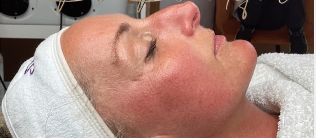 collagen boosting skin treatment for greater confidence - SkinBase Collagen Lift ULTIMATE Be Beautiful Torbay 2