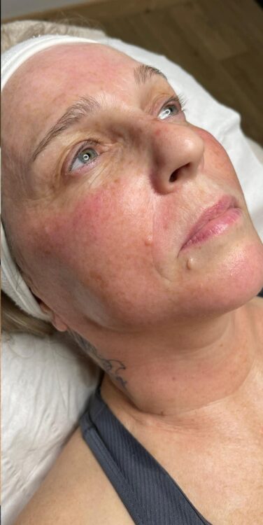 confidence boosting facial for rejuvenated skin SkinBase Collagen Lift ULTIMATE wood & co salon & training 2
