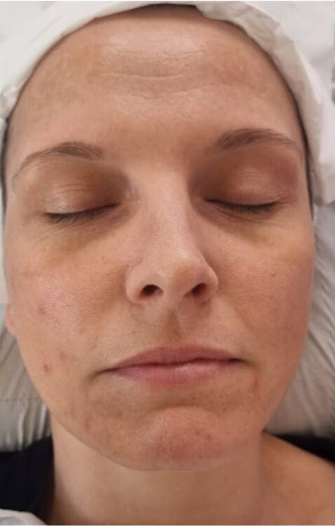 facial refresh hydro facial before and after SkinBase Glam Beauty Education 1