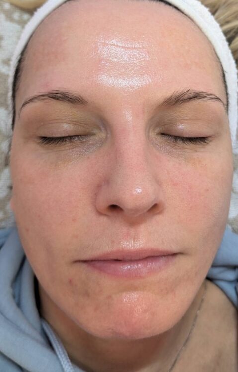 facial refresh hydro facial before and after SkinBase Glam Beauty Education 2