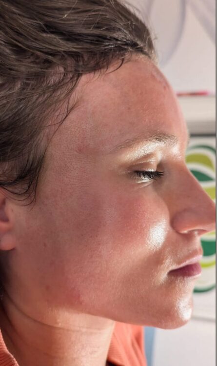 microdermabrasion for fine lines and wrinkles results Gaby Massage & Beauty 2