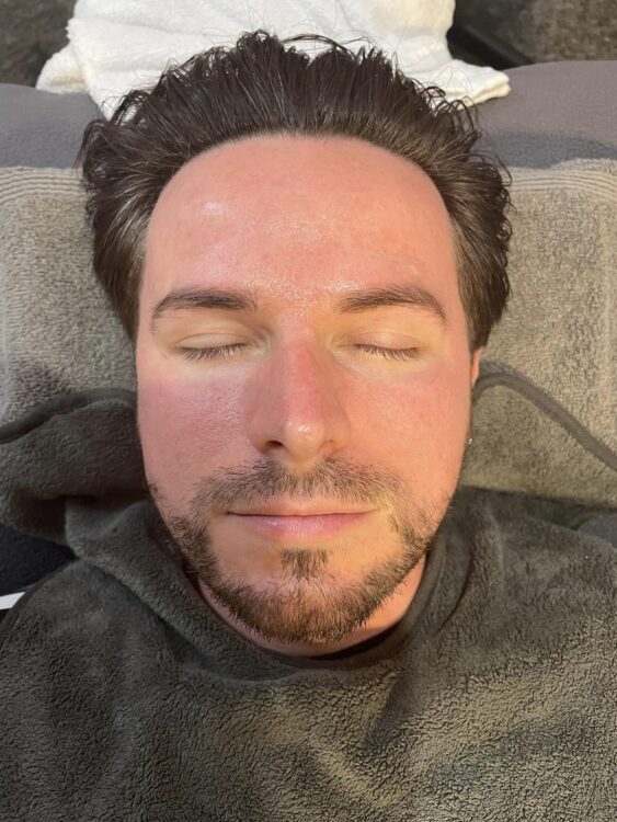 microdermabrasion for men results DV massage and skincare 2