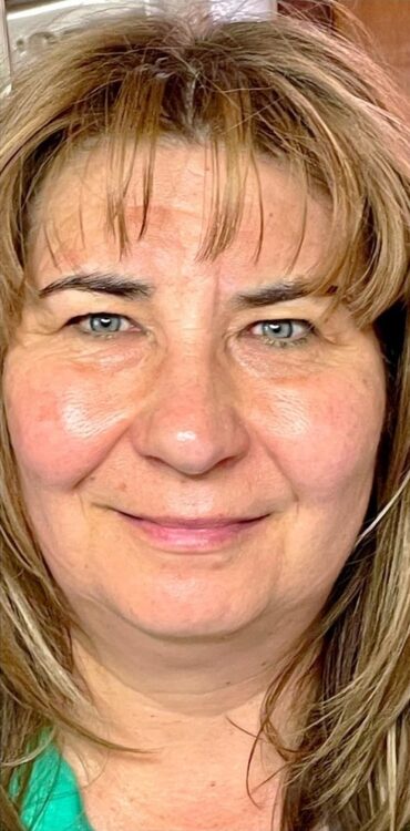 non-surgical skin treatment for dull and textured skin Collagen Lift ULTIMATE Bijou Beauty 2