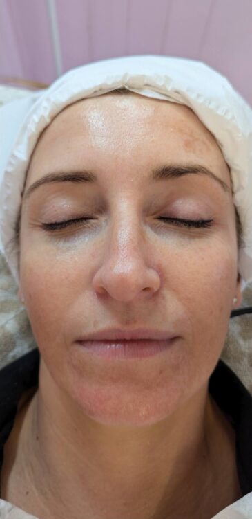 the best alternative to a facelift - SkinBase Collagen Lift facial results Glam Beauty Education 1