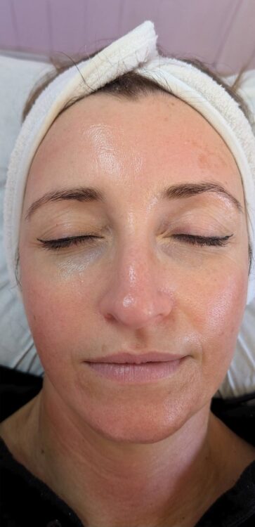 the best alternative to a facelift - SkinBase Collagen Lift facial results Glam Beauty Education 2