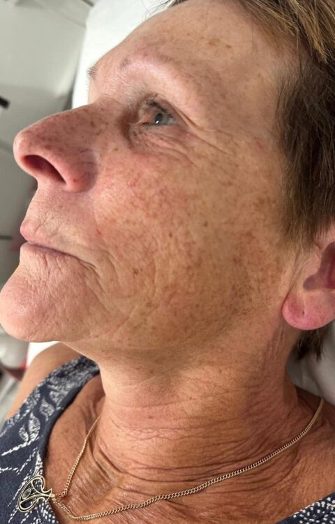 the best facial for ageing skin Katherine Monique Beauty 1