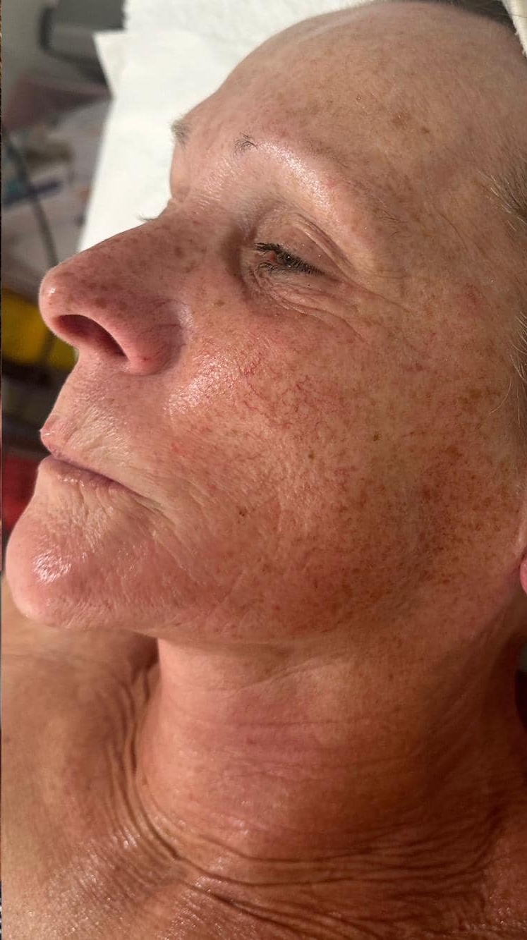the best facial for ageing skin Katherine Monique Beauty 2