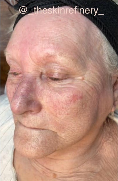 the best facial for refreshing mature skin SkinBase Collagen Lift ULTIMATE The Skin Refinery 1