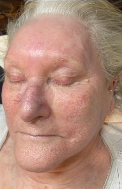 the best facial for refreshing mature skin SkinBase Collagen Lift ULTIMATE The Skin Refinery 2