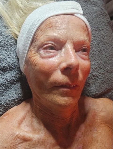 the best smoothing face and neck treatment results SkinBase Collagen Lift radiofrequency Lisa Burke Health & Beauty 1