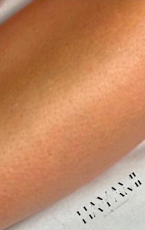 unwanted hair removal results SkinBase IPL legs treatment January Hayami Cosmetics