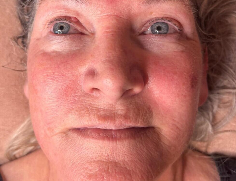 the ultimate collagen treatment for ageing skin January The Beauty Rooms
