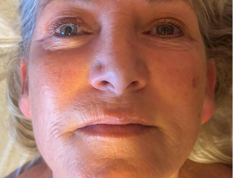 the ultimate collagen treatment for ageing skin January The Beauty Rooms