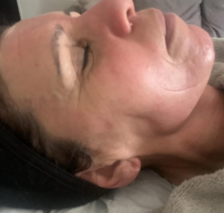 the best advanced treatment for ageing skin SkinBase combination treatment January Theblissfulbeautycompany