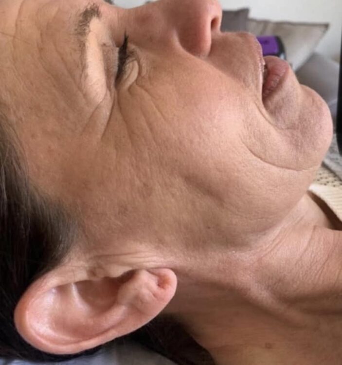 the best advanced treatment for ageing skin SkinBase combination treatment January Theblissfulbeautycompany