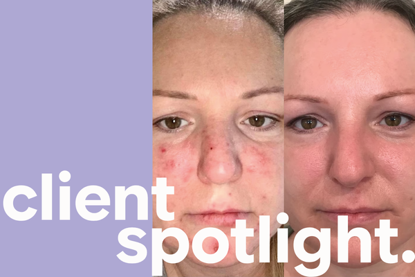 client spotlight transformation of the year winner carla