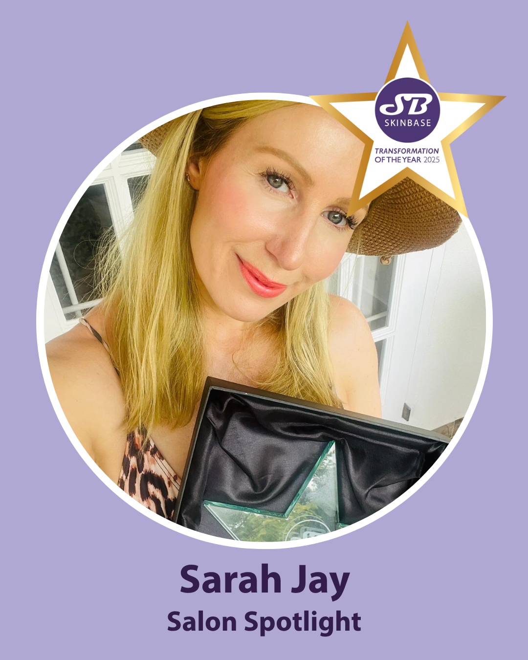 how to treat pigmentation - Sarah jay the jays nest