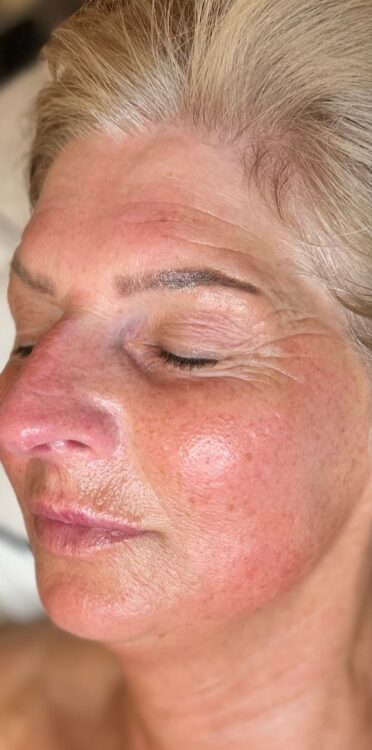 April Collagen Lift Jasper Rose Beauty glowing skin radio frequency after