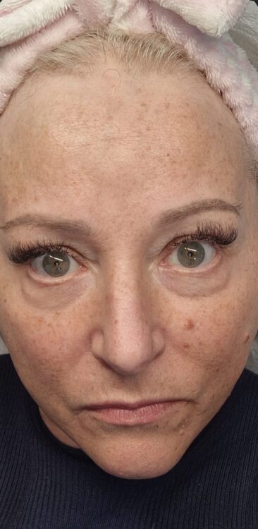 February Studio 333 Hydro face dryness puffiness before