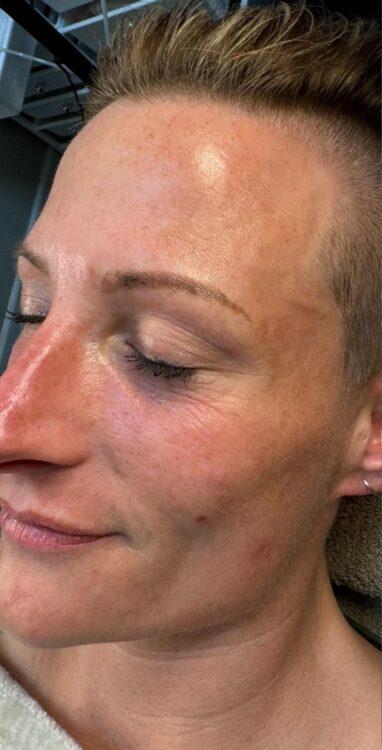 June Avenue Beauty Bar Hydro dull ageing skin before