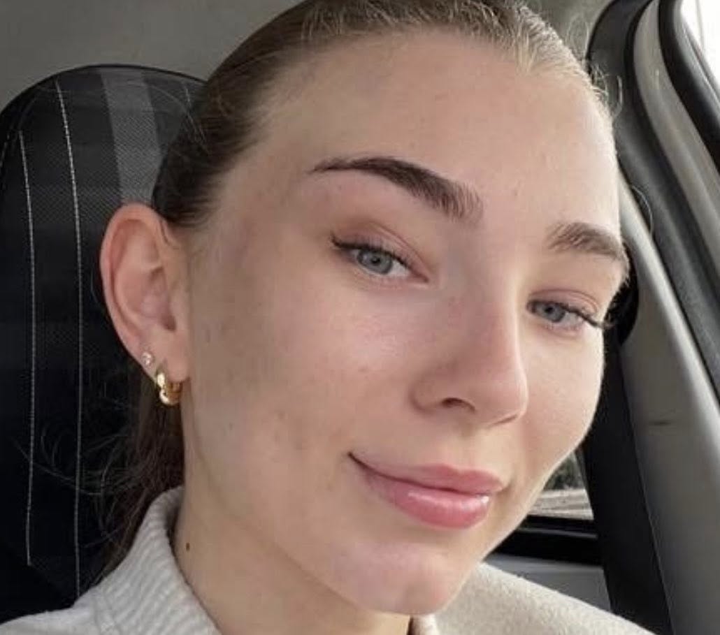 June Pampered by Elaine Hydro acne face after