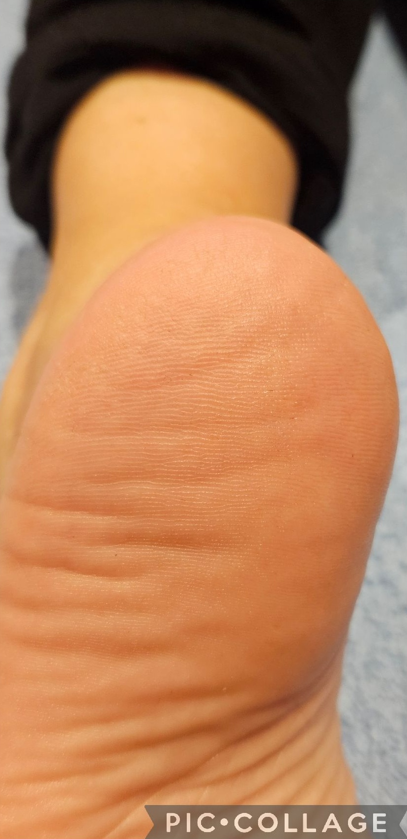 June The Beauty Room Microdermabrasion feet pedicure after